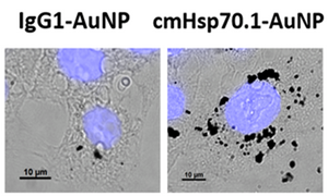 Gold Nanoparticle CT Image