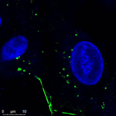 Confocal Image of Nanopartz Gold Nanorods