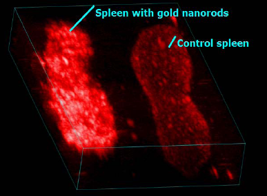 In Vivo Gold Nanoparticles for Cancer Therapeutics & Diagnostics ...