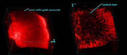 In Vivo Gold Nanoparticles for Cancer Therapeutics & Diagnostics ...