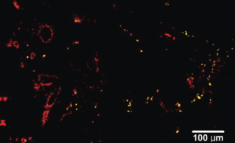 In Vivo Gold Nanoparticles for Cancer Therapeutics & Diagnostics ...